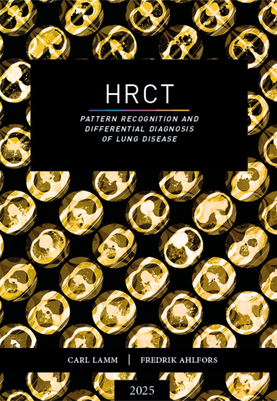 HRCT – pattern recognition and differential diagnosis of lung disease