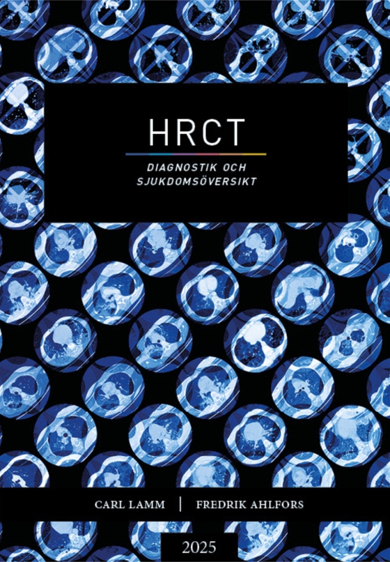 HRCT – Diagnostik och sjukdomsöversikt